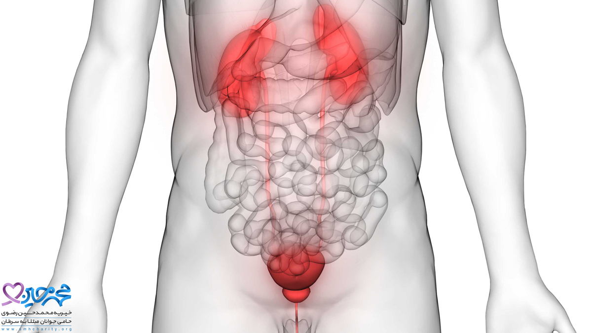 نکات موثر در رابطه با سرطان مثانه در خانم ها و آقایان