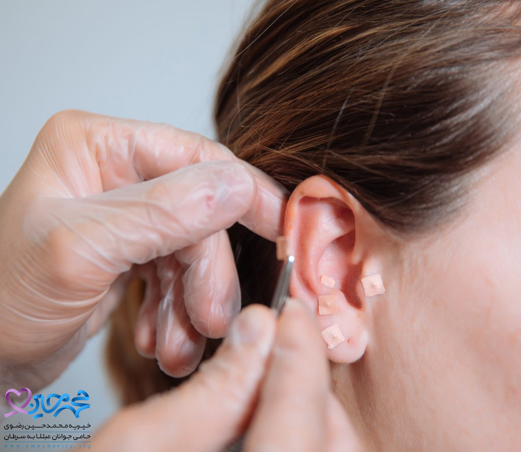 سرطان لاله گوش چیست