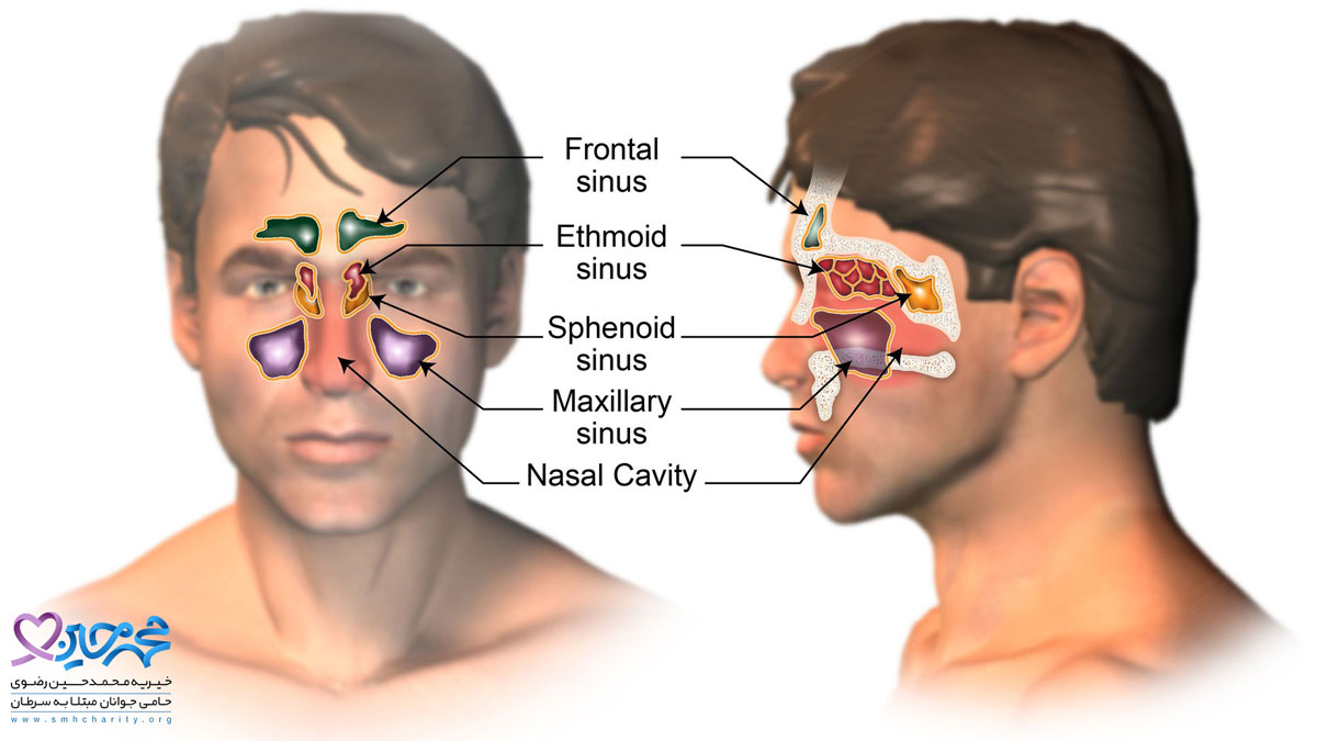 علائم و نشانه‌های سرطان بینی و سینوس