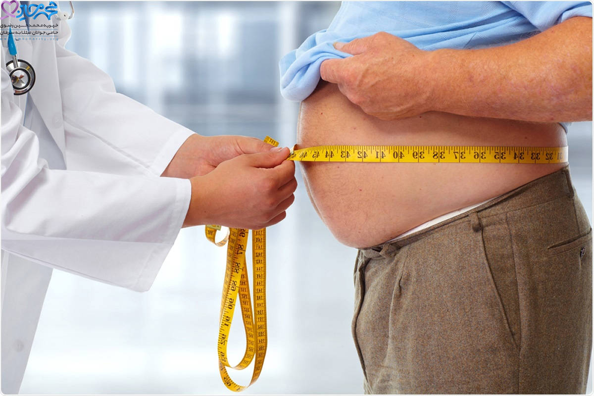 ارتباط بین چاقی بدن و سرطان روده بزرگ