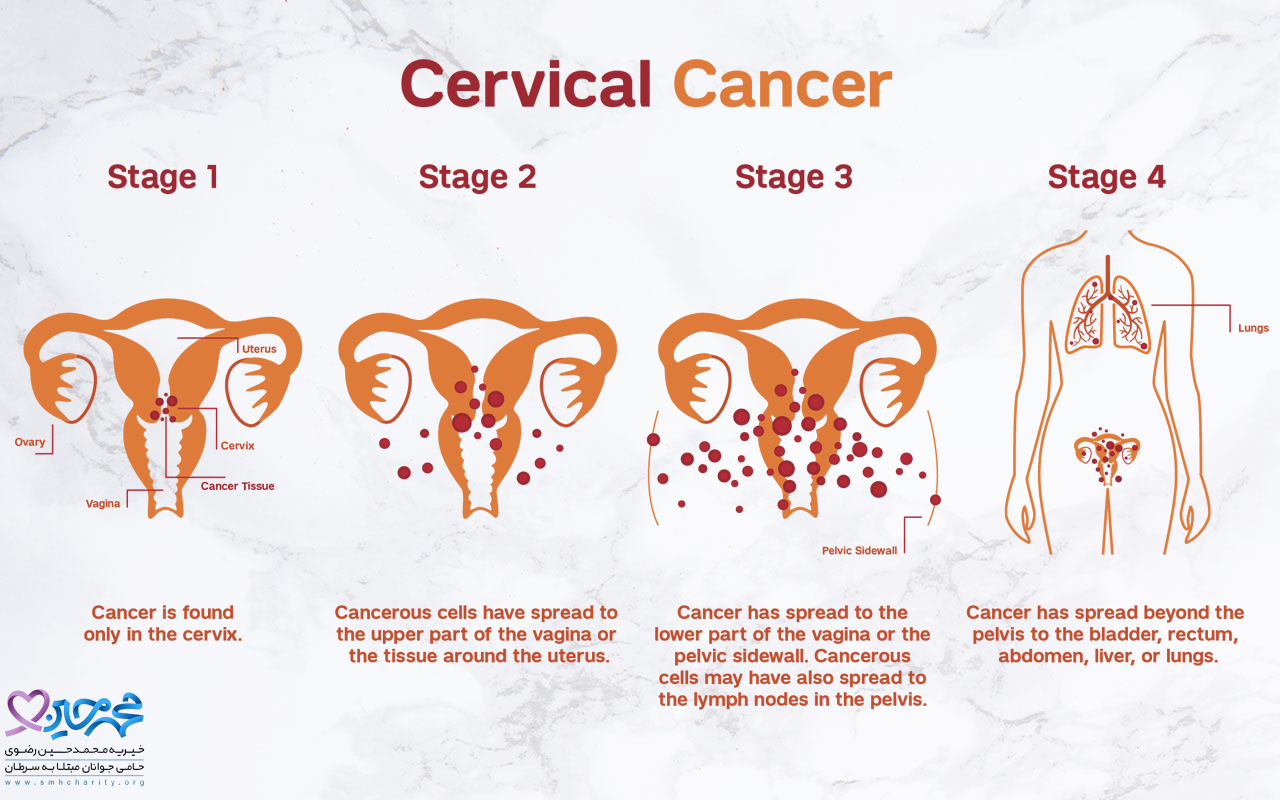 سرطان دهانه رحم چیست