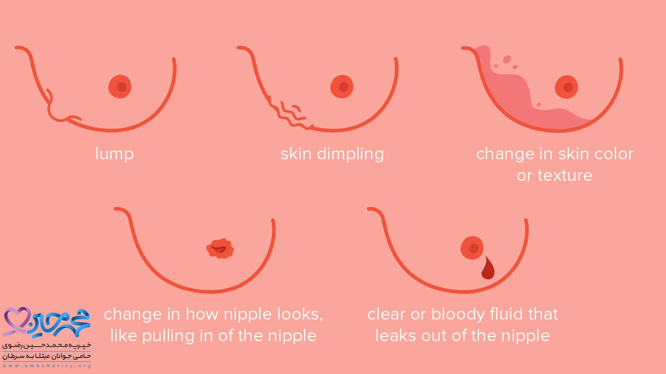  تغییرات پوست در سرطان سینه