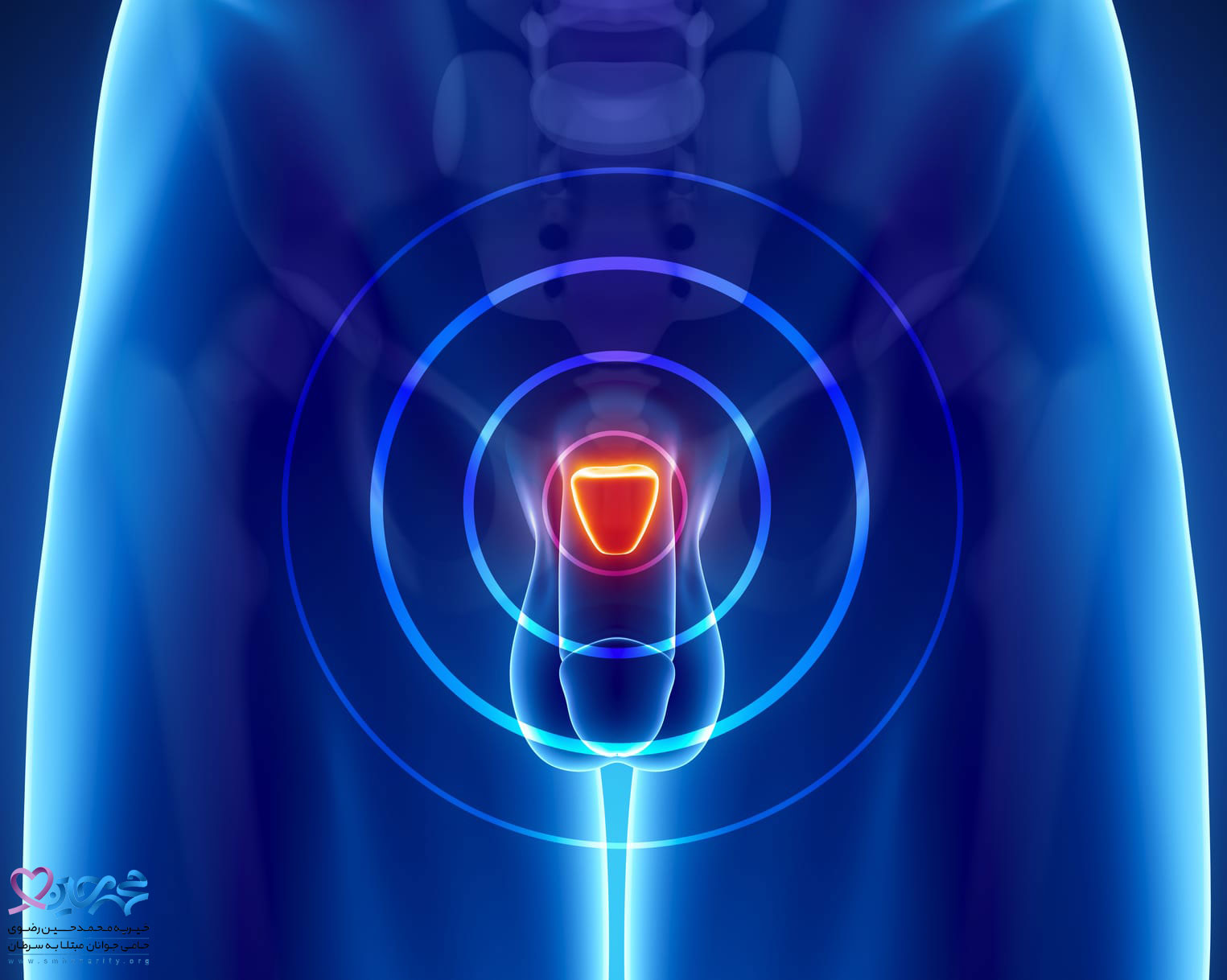 علل بروز سرطان پروستات
