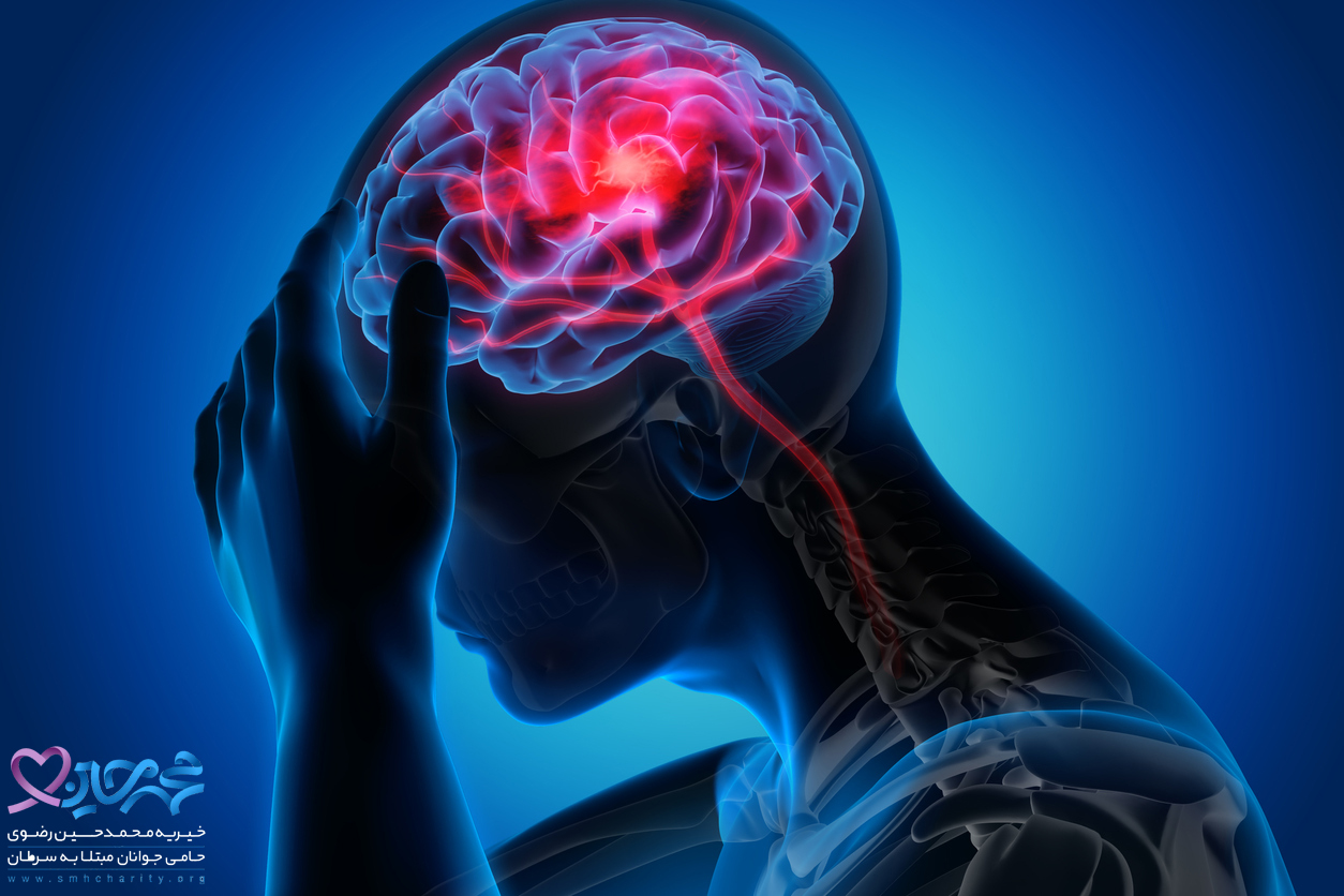 علائم و نشانه های سکته مغزی چیست؟