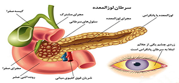 زردی