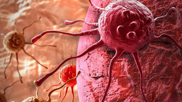 تفاوت سلول سرطانی با سلول سالم - بیماری سرطان