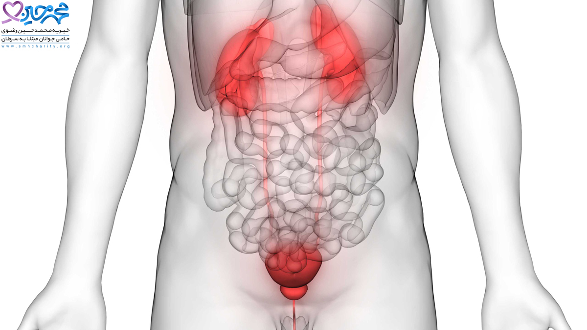 پیشگیری از سرطان مثانه|علائم سرطان مثانه|سرطان مثانه در مردان|درمان بیماری های مثانه|سرطان مثانه یا تومور مثانه چیست|انوع سرطان مثانه|