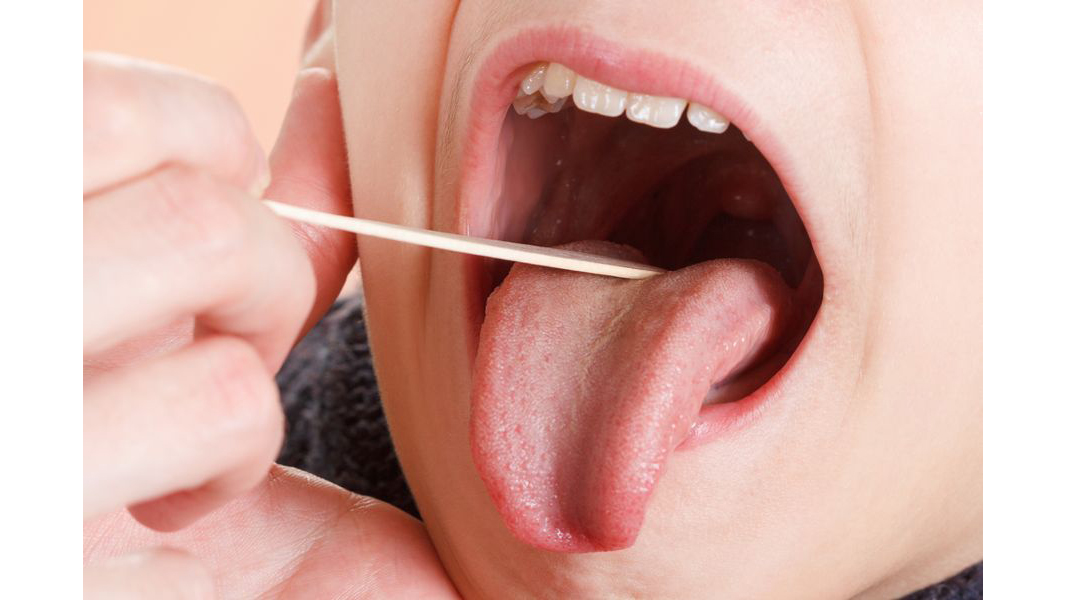 سرطان دهان و زبان چیست؟