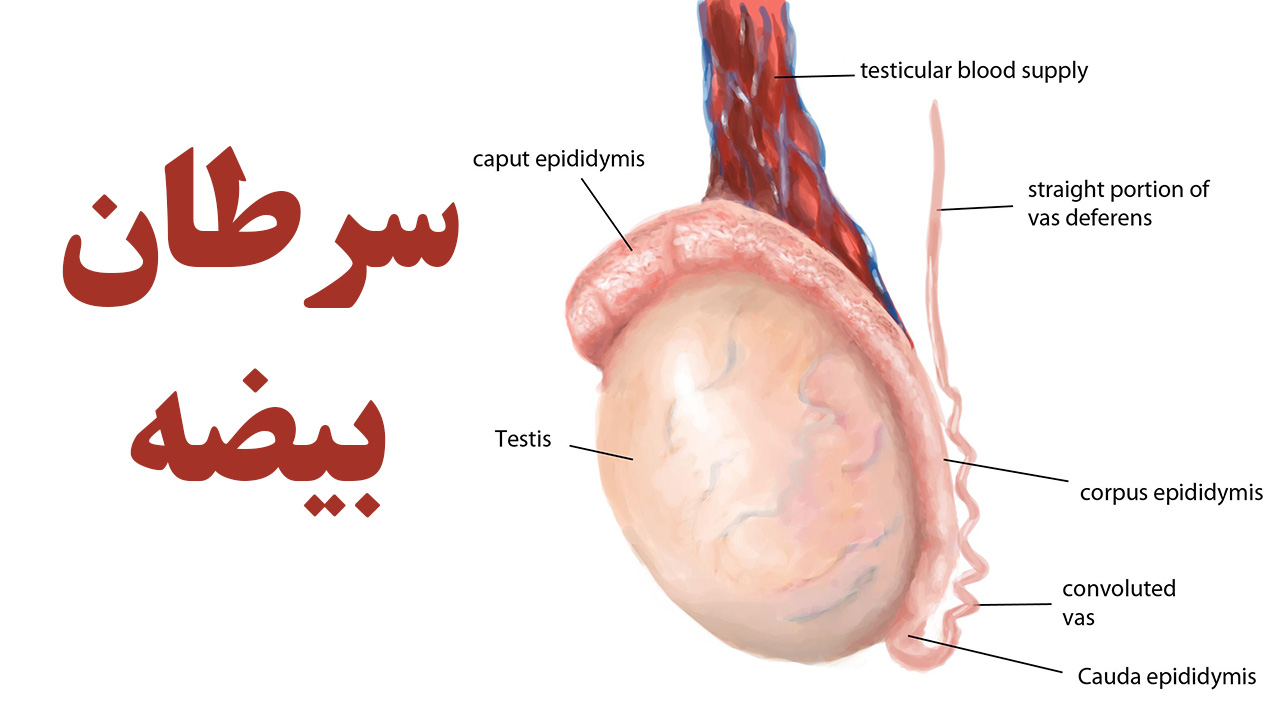 سرطان بیضه| درمان سرطان| ابتلا به سرطان | راه های درمان سرطان بیضه | 