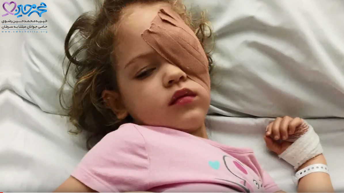 سرطان چشم|سرطان چشم در کودکان
