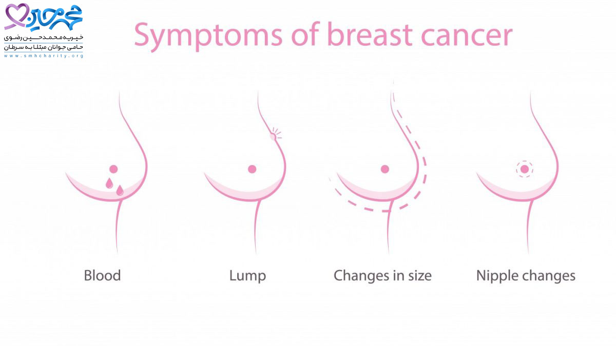 سرطان سینه چه نشانه ها و علائمی دارد|سرطان سینه|سن سرطان سینه زنان|