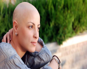 ریزش موها و سرطان