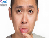  چه زمانی آفت دهانی موجب سرطان دهان می شود؟ 