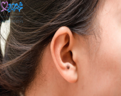 علائم سرطان لاله گوش چیست؟