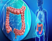  سرطان کولورکتال متاستاتیک و علائم آن