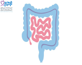 سرطان کولورکتال چیست؟