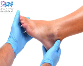 نشانه های سرطان در پا و قوزک پا کدام است؟